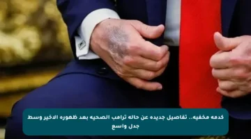 كدمة مخفية.. تفاصيل جديدة عن حالة ترامب الصحية بعد ظهوره الأخير وسط جدل واسع